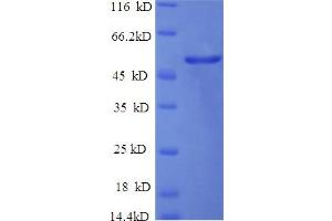 SDS-PAGE (SDS) image for Cerebellar Degeneration-Related Protein 2, 62kDa (CDR2) (AA 1-454), (full length) protein (His tag) (ABIN5709269)