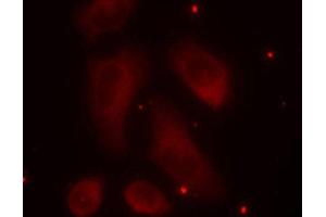 Immunofluorescence staining of methanol-fixed Hela cells using Phospho-LIMK1-T508 antibody. (LIM Domain Kinase 1 抗体  (pThr508))