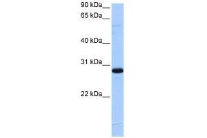 WB Suggested Anti-C1orf83 Antibody Titration:  0. (TCEANC2 抗体  (N-Term))