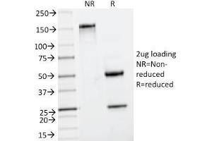 SDS-PAGE Analysis Purified Insulin Mouse Monoclonal Antibody (IRDN/794). (Insulin 抗体)