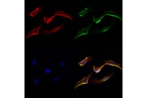 ABIN6265714 and ABIN6277332 staining Hela cells by IF/ICC. (TRAP1 抗体  (Internal Region))