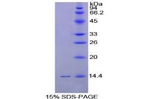 SDS-PAGE analysis of Chicken GnRH Protein. (GNRH1 蛋白)