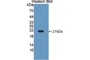 Detection of Recombinant HBb, Bovine using Polyclonal Antibody to Hemoglobin Beta (HBb) (Hemoglobin Subunit beta 抗体  (AA 1-145))