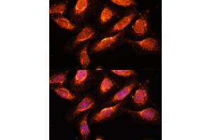 Immunofluorescence analysis of U-2 OS cells using RA antibody (ABIN7269798) at dilution of 1:100. (RAB1A 抗体  (AA 1-205))