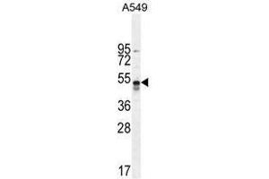 hTNFR-pS274 western blot analysis in A549 cell line lysates (35 µg/lane). (TNFRSF1A 抗体  (AA 259-288))