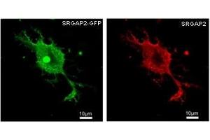 HEK293 overexpressing human SRGAP2 and probed with GFP (green) and SRGAP2 (red) antibody at 2. (SRGAP2 抗体)