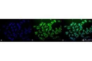 Immunocytochemistry/Immunofluorescence analysis using Mouse Anti-Ubiquitin Monoclonal Antibody, Clone 6C11-B3 . (Ubiquitin 抗体  (Biotin))