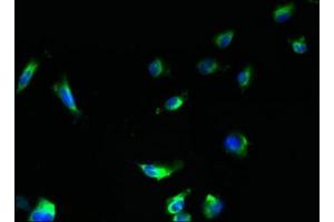 Immunofluorescent analysis of U251 cells using ABIN7175449 at dilution of 1:100 and Alexa Fluor 488-congugated AffiniPure Goat Anti-Rabbit IgG(H+L)