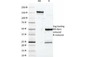 SDS-PAGE Analysis Purified SOX10 Mouse Monoclonal Antibody (SOX10/992). (SOX10 抗体  (AA 115-269))