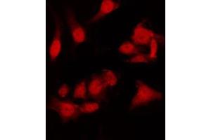 ABIN6275007 staining HT29 by IF/ICC. (CLIC4 抗体  (N-Term))
