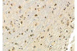 ABIN6262343 and ABIN6279489 at 1/100 staining Rat brain tissue by IHC-P.