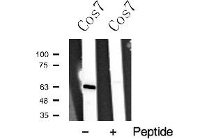Western blot analysis of p63 expression in Cos7 cell extract (p63 抗体)
