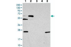 Western blot analysis of Lane 1: RT-4, Lane 2: U-251 MG, Lane 3: Human Plasma, Lane 4: Liver, Lane 5: Tonsil with C10orf33 polyclonal antibody . (PYROXD2 抗体)