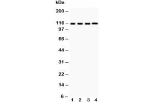Western blot testing of NALP3 antibody and Lane 1:  HeLa;  2: MCF-7;  3: Jurkat;  4: HEPG2 (NLRP3 抗体  (AA 21-194))