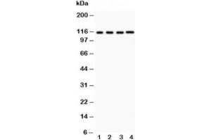 Western blot testing of NALP3 antibody and Lane 1:  HeLa;  2: MCF-7;  3: Jurkat;  4: HEPG2 (NLRP3 抗体  (AA 21-194))