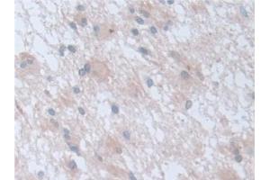 Immunohistochemistry (IHC) image for anti-Retinoic Acid Receptor, alpha (RARA) (AA 68-173) antibody (ABIN7432958)