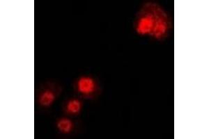 Immunofluorescent analysis of Alpha-tubulin 4a staining in U2OS cells. (TUBA4A 抗体)