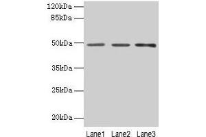 Western blot All lanes: PSG6 antibody at 6 μg/mL Lane 1: HepG2 whole cell lysate Lane 2: 293T whole cell lysate Lane 3: MCF-7 whole cell lysate Secondary Goat polyclonal to rabbit IgG at 1/10000 dilution Predicted band size: 49, 48 kDa Observed band size: 49 kDa