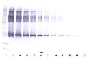 Image no. 1 for anti-serpin Peptidase Inhibitor, Clade A (Alpha-1 Antiproteinase, Antitrypsin), Member 12 (SERPINA12) antibody (ABIN465901) (SERPINA12 抗体)
