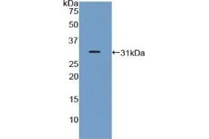 Detection of Recombinant GHR, Mouse using Polyclonal Antibody to Growth Hormone Receptor (GHR) (Growth Hormone Receptor 抗体  (AA 36-266))