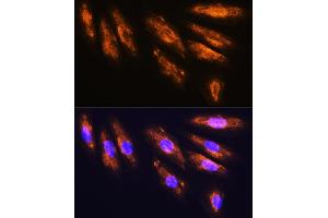 Immunofluorescence (IF) image for anti-Glutamate Receptor, Ionotropic, N-Methyl D-Aspartate 2a (GRIN2A) (AA 1130-1400) antibody (ABIN1681064)