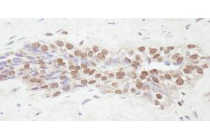 Immunohistochemistry (IHC) image for anti-Nuclear Receptor Coactivator 2 (NCOA2) (C-Term) antibody (ABIN7448683) (NCOA2 抗体  (C-Term))