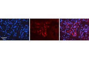 Rabbit Anti-RET Antibody Catalog Number: ARP30878_P050 Formalin Fixed Paraffin Embedded Tissue: Human Testis Tissue Observed Staining: Cytoplasm Primary Antibody Concentration: 1:600 Other Working Concentrations: N/A Secondary Antibody: Donkey anti-Rabbit-Cy3 Secondary Antibody Concentration: 1:200 Magnification: 20X Exposure Time: 0.