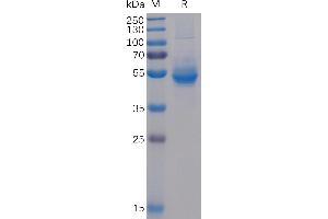 SDS-PAGE (SDS) image for Inducible T-Cell Co-Stimulator (ICOS) (AA 21-140) protein (mFc-His Tag) (ABIN6961099)