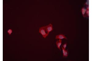 ABIN6274009 staining HeLa cells by ICC/IF. (ENO1 抗体  (C-Term))