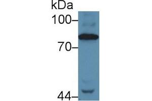 Western Blot; Sample: Human Serum; Primary Ab: 5µg/ml Rabbit Anti-Human C4 Antibody Second Ab: 0. (Complement C4 抗体  (AA 975-1336))