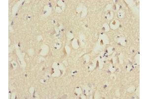 Immunohistochemistry of paraffin-embedded human brain tissue using ABIN7151071 at dilution of 1:100 (MID1 抗体  (AA 478-667))