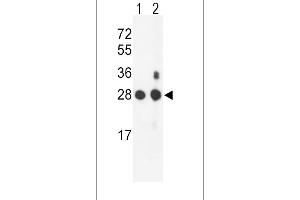 Western blot analysis of PSMB1 Antibody (C-term) (ABIN652802 and ABIN2842525) in mouse NIH-3T3 cell line(lane 1) and mouse bladder tissue(lane 2) lysates (35 μg/lane). (PSMB1 抗体  (C-Term))
