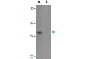 Western blot analysis of ACOT13 in HepG2 cell lysate with ACOT13 polyclonal antibody  at 1 ug/mL in (A) the absence and (B) the presence of blocking peptide. (THEM2 抗体  (C-Term))