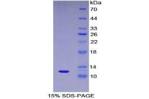 SDS-PAGE analysis of Human MIP5 Protein. (CCL15 蛋白)