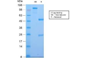 SDS-PAGE Analysis of Purified CELA3B Rabbit Recombinant Monoclonal Antibody (CELA3B/2810R). (Recombinant Elastase 3B 抗体  (AA 82-238))