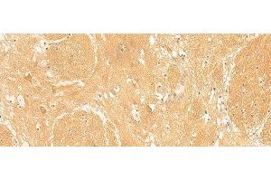 Immunohistochemistry of paraffin-embedded Human brain tissue using ARPC5L Polyclonal Antibody at dilution of 1:30(x200) (ARPC5L 抗体)