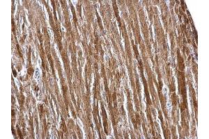 Immunohistochemistry (IHC) image for anti-Electron-Transfer-Flavoprotein, alpha Polypeptide (ETFA) (Center) antibody (ABIN2856049)
