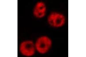 Immunofluorescence (fixed cells) (IF/ICC) image for anti-ATR Interacting Protein (ATRIP) (N-Term) antibody (ABIN6260146)