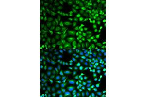 Immunofluorescence (IF) image for anti-Eukaryotic Translation Initiation Factor 5A (EIF5A) (AA 1-154) antibody (ABIN3015836)