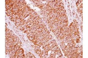 Image no. 3 for anti-Eukaryotic Translation Initiation Factor 2, Subunit 2 Beta, 38kDa (EIF2S2) (AA 1-216) antibody (ABIN1497973)