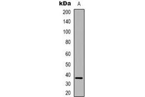 Western blot analysis of FAM84B expression in HUVEC (A) whole cell lysates. (FAM84B 抗体  (N-Term))