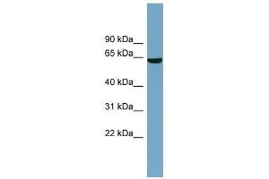 SLC5A8 antibody used at 1 ug/ml to detect target protein.