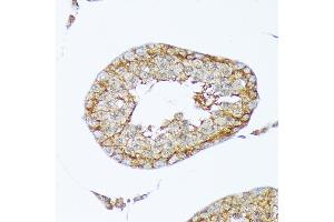 Immunohistochemistry of paraffin-embedded rat testis using Cortactin Rabbit mAb (ABIN7266511) at dilution of 1:100 (40x lens). (Cortactin 抗体)