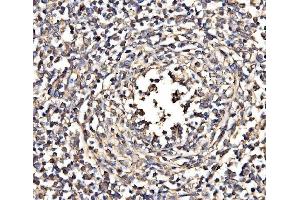 IHC analysis of NEAS/SPTAN1 using anti-NEAS/SPTAN1 antibody (ABIN7600436).