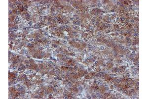 Image no. 9 for anti-Iduronate 2-Sulfatase (IDS) antibody (ABIN1498798)