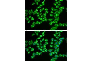 Immunofluorescence (IF) image for anti-Hydroxyacyl-CoA Dehydrogenase/3-Ketoacyl-CoA Thiolase/enoyl-CoA Hydratase (Trifunctional Protein), beta Subunit (HADHB) (AA 34-270) antibody (ABIN6141589)