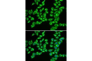 Immunofluorescence analysis of A549 cells using HADHB antibody. (HADHB 抗体  (AA 34-270))