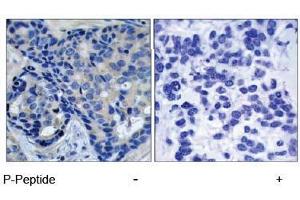 Image no. 1 for anti-PTK2B Protein tyrosine Kinase 2 beta (PTK2B) (pTyr402) antibody (ABIN196952) (PTK2B 抗体  (pTyr402))