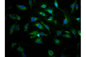 Immunofluorescence (IF) image for anti-ATP-Binding Cassette, Sub-Family C (CFTR/MRP), Member 8 (ABCC8) (AA 729-838) antibody (ABIN7144904)