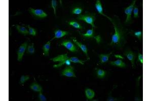 Immunofluorescence staining of U251 cells with ABIN7144904 at 1:166, counter-stained with DAPI. (ABCC8 抗体  (AA 729-838))